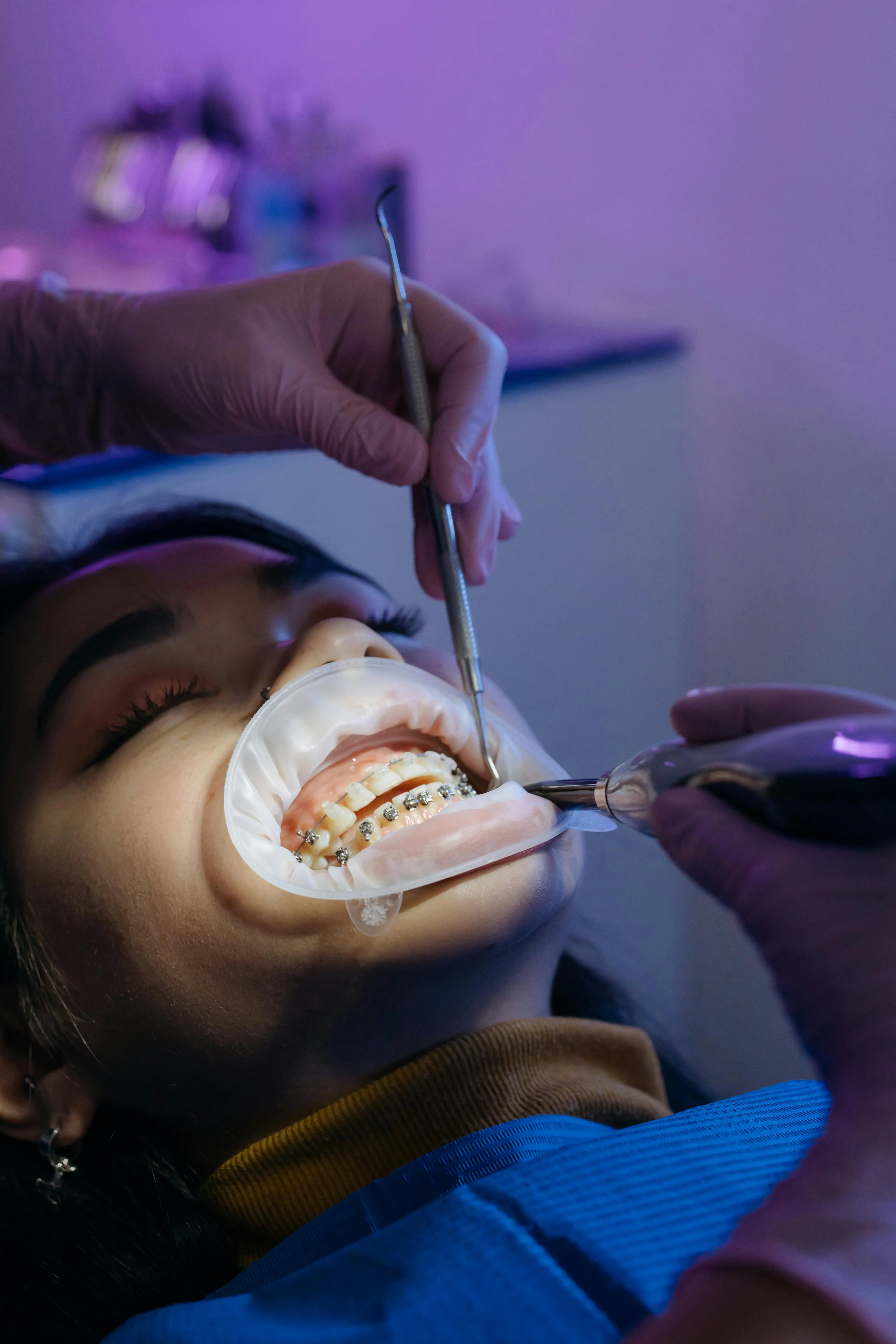 Brackets & Braces