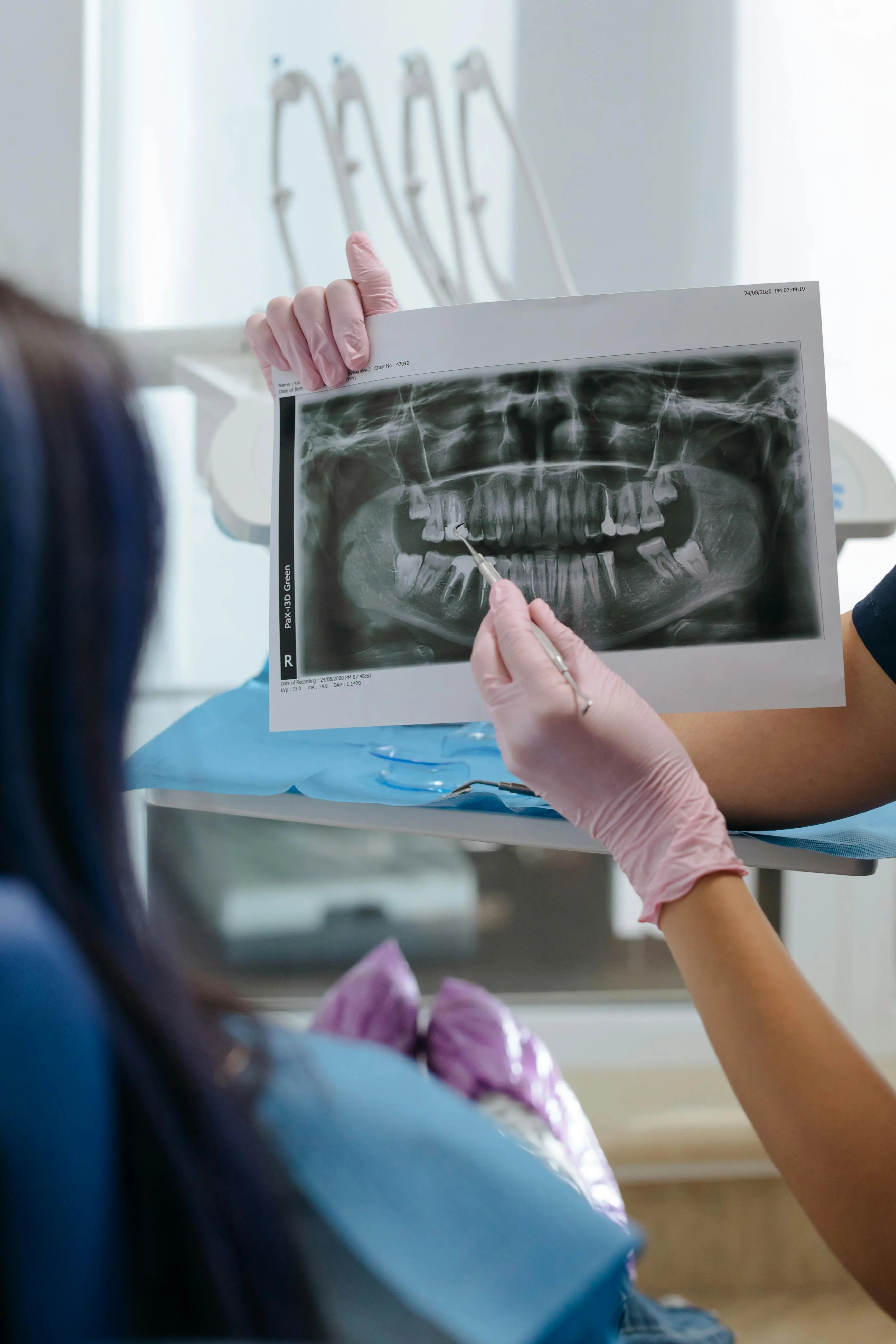 Dental Implants