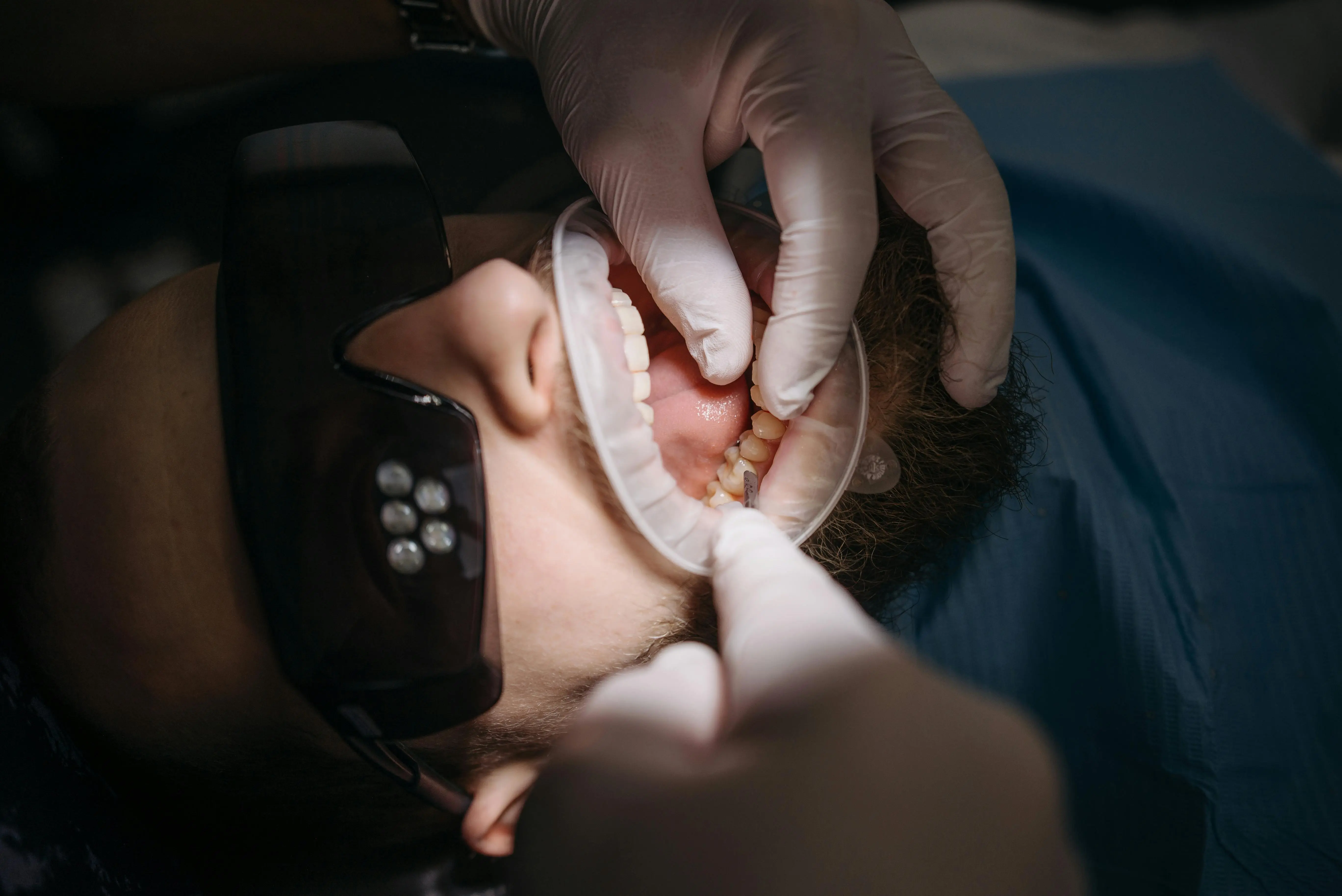 Gum Disease Treatments